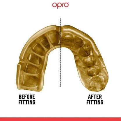 OPRO Gold Ultra Fit Mouthguard - Adult - 10 Years + - Red/White